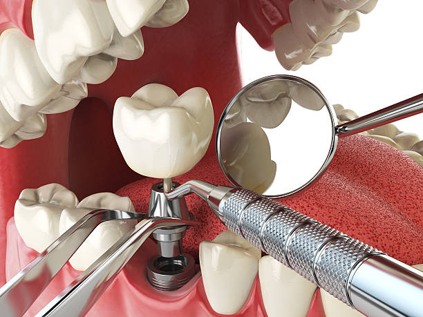 Best Emergency Cosmetic Dentistry in Blakely, GA